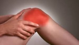 arthritis pain relief